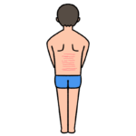 男性の背中の肉割れのイラスト